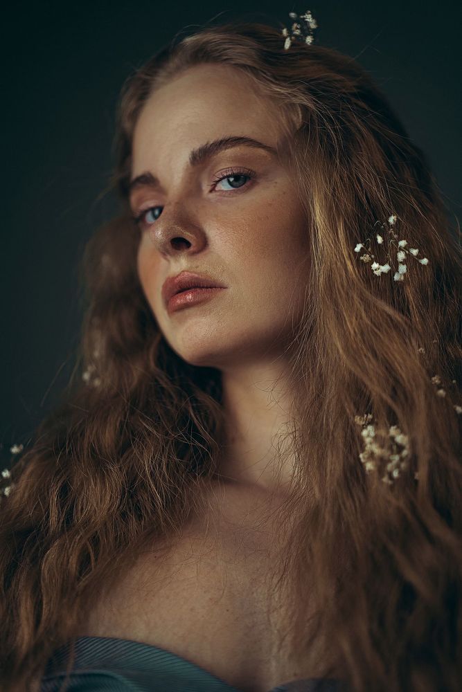 Albina