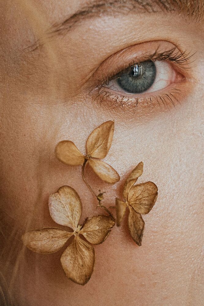 Albina and flower