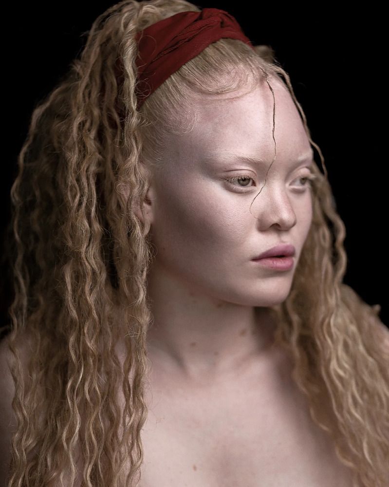Albina Afro