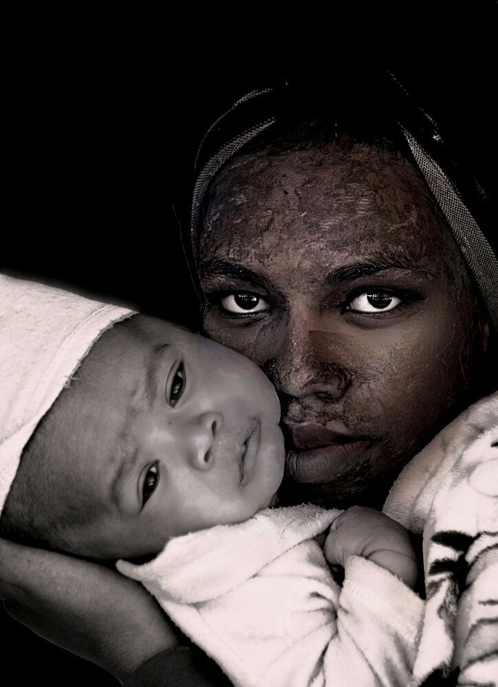 Fragile mankind