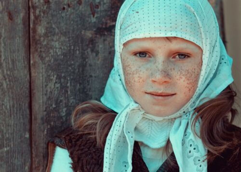 Альбинка