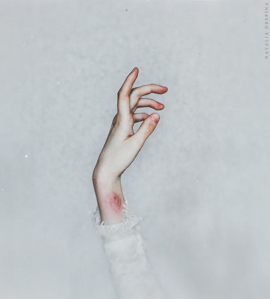 Bruisegraphy
