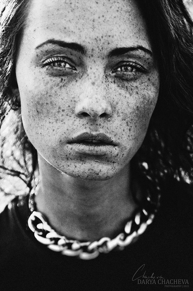 Freckles are still sexual