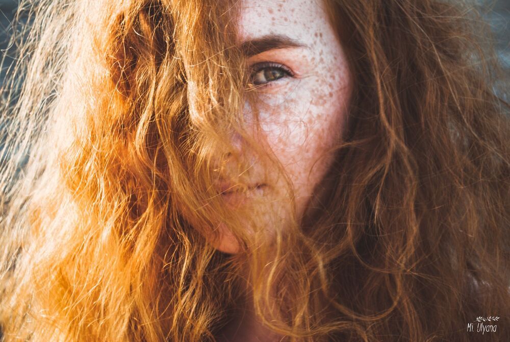 Sun and freckles