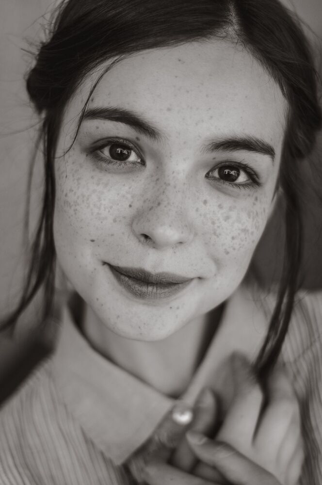 freckled miracle
