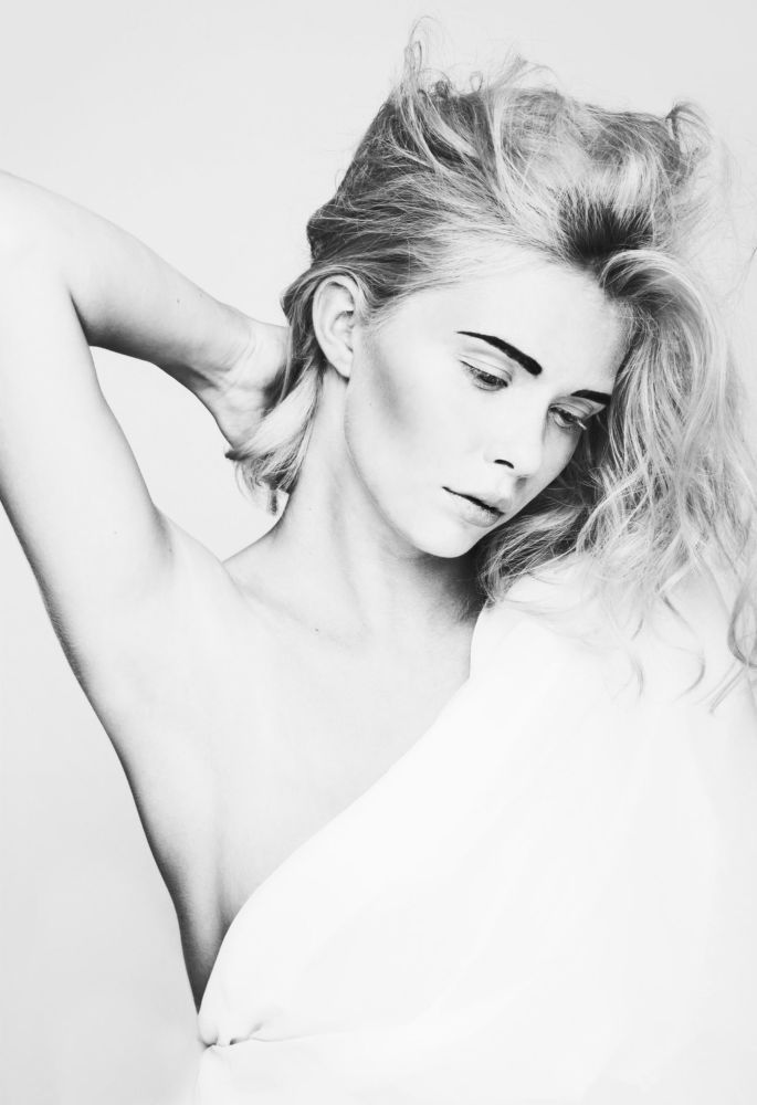 Albino