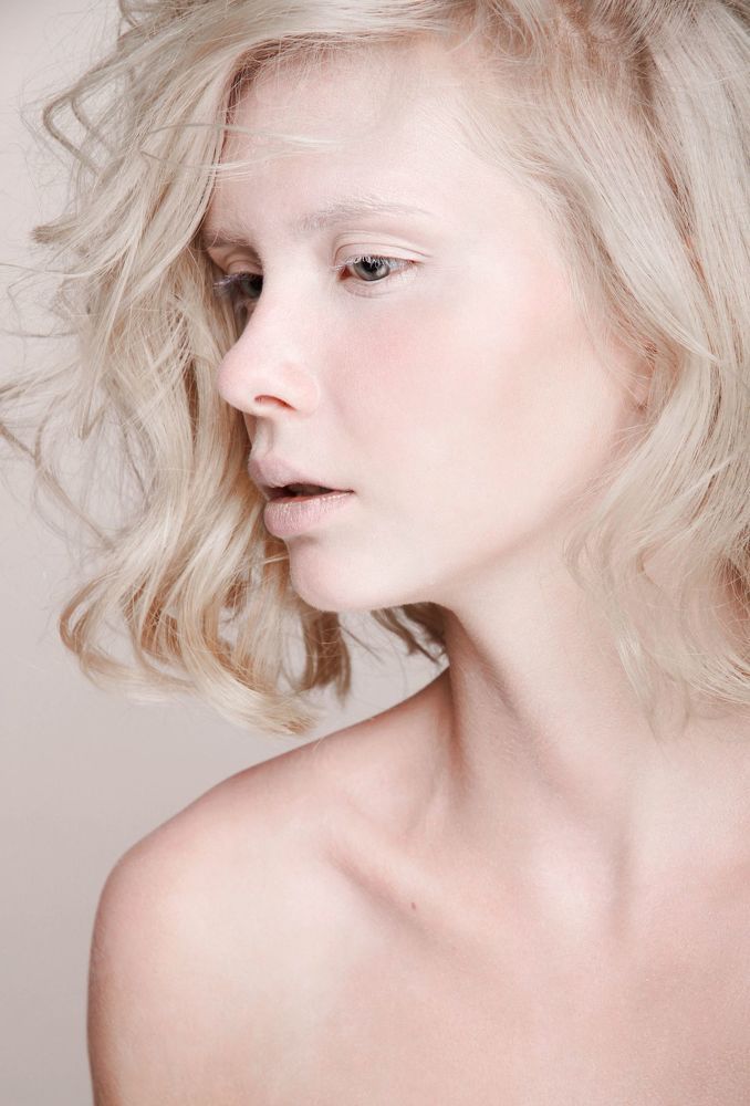 Albino