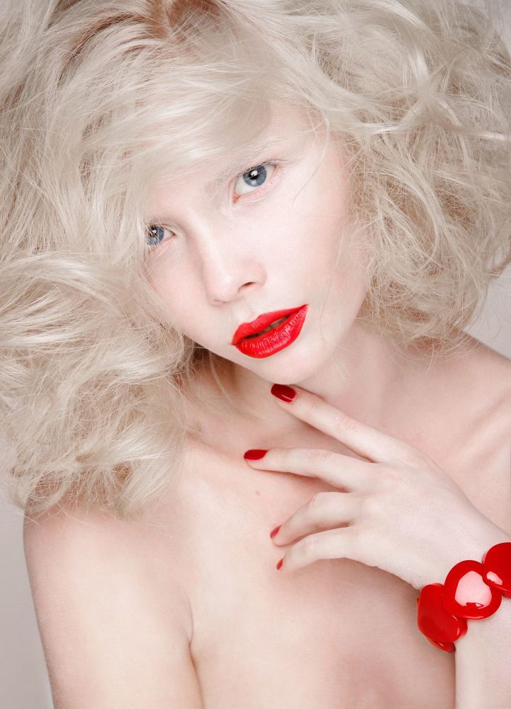 Albino