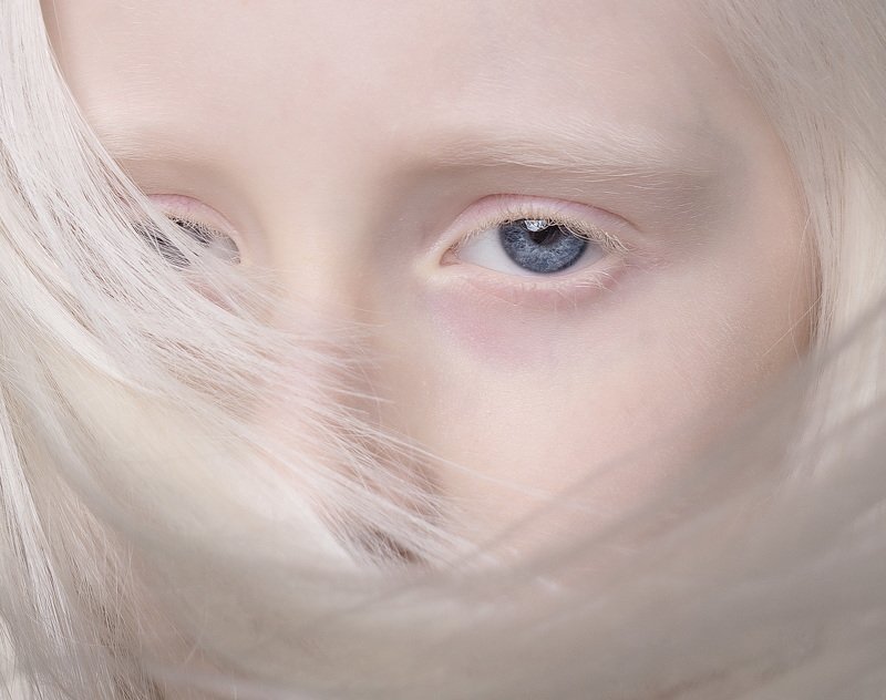 Естественность , альбинизм  Ангел фото превью