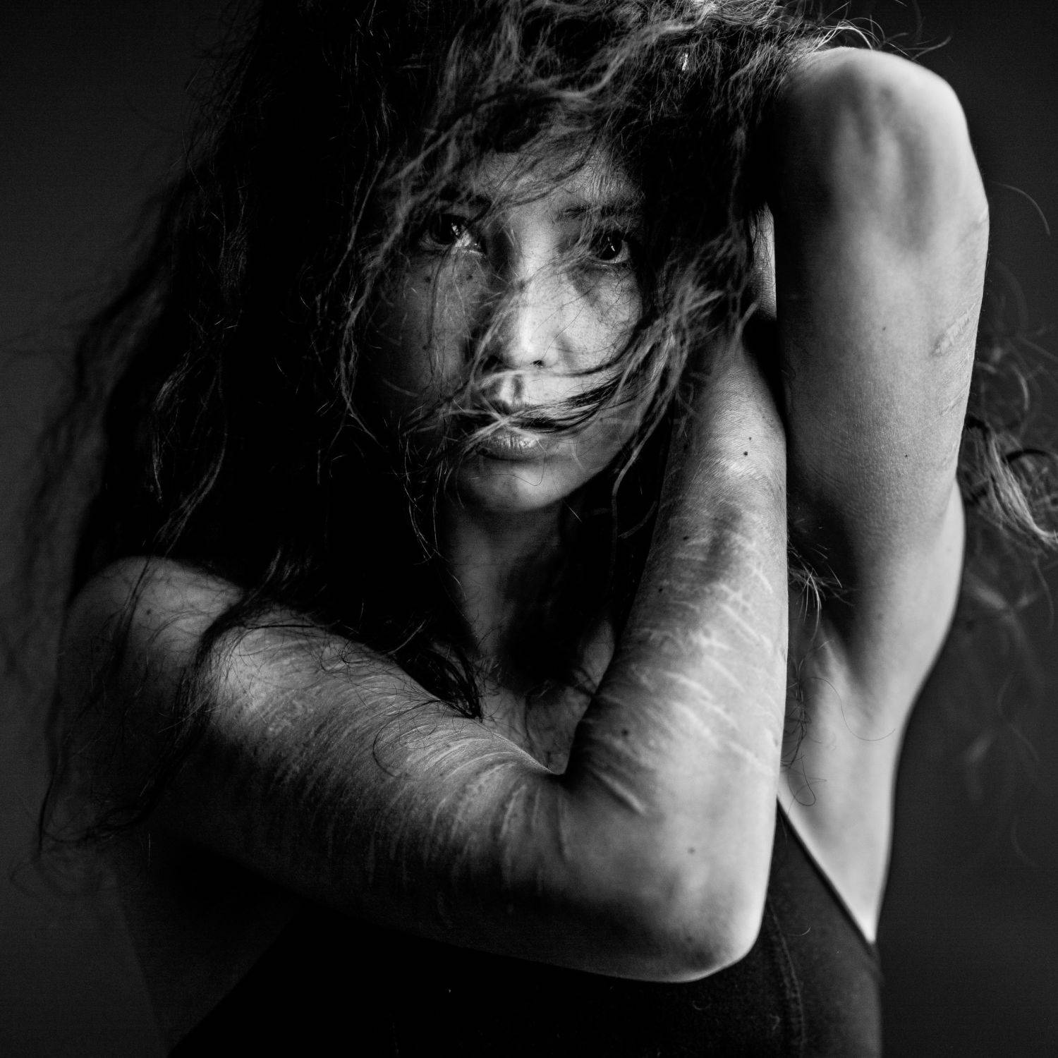 beauty, female, woman, eyes, black, white, studio, portrait, canon, godox, hair, nose, lips, scars, strong, Rene Kuipers