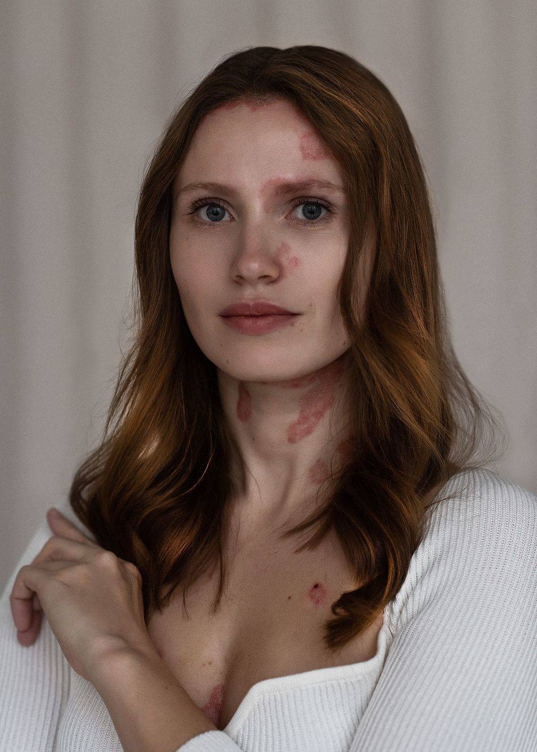 , Анна Бердникова