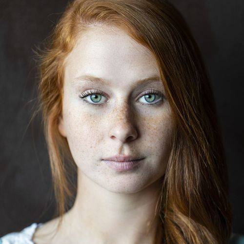 Freckles Face
