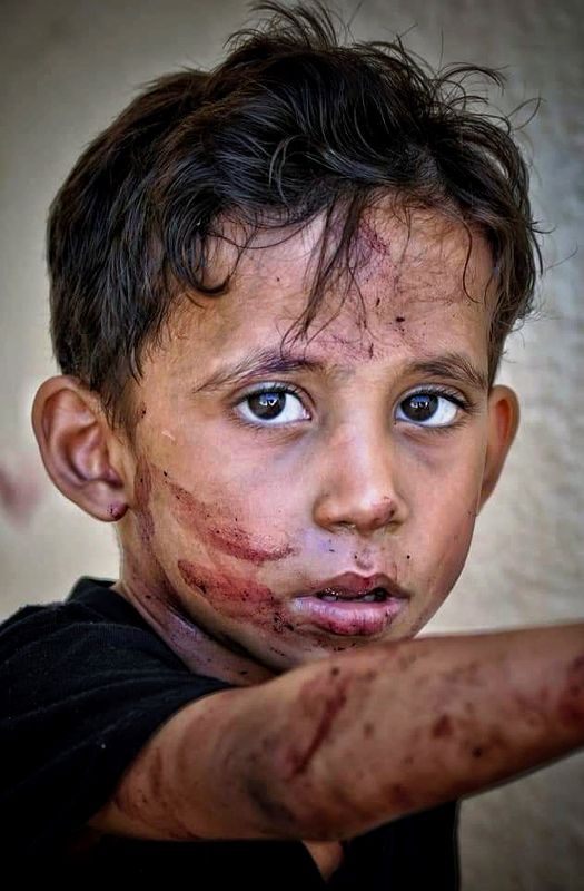 The United Nations and human rights are a big lie... a world covered in blood фото превью