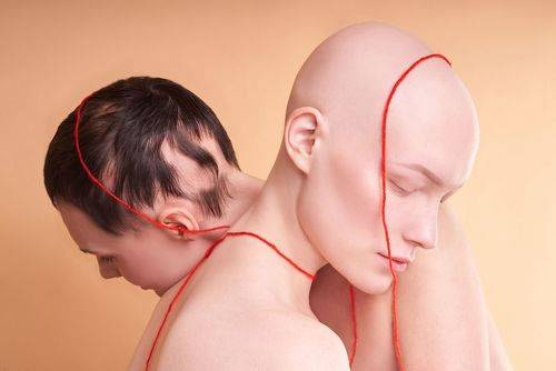 Алопеция на разных стадиях 