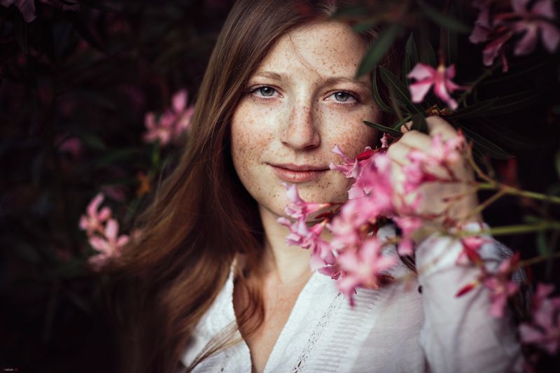 Freckles фото превью