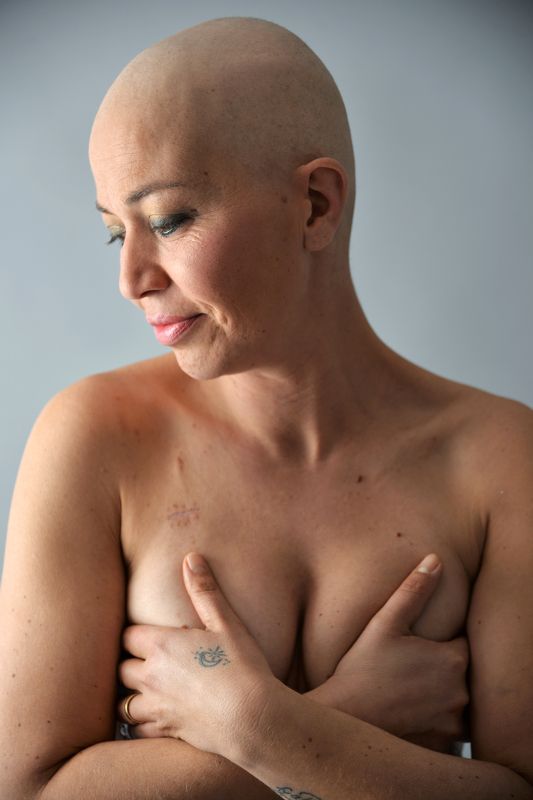 2 фото превью