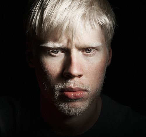 Albino