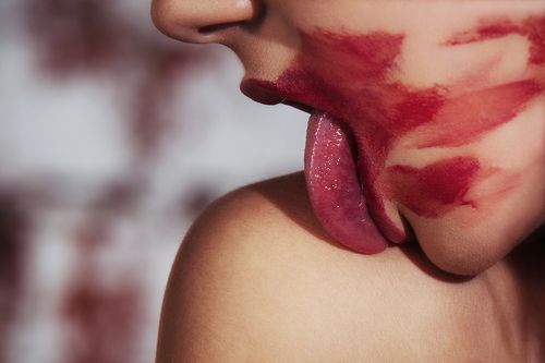 Kiss