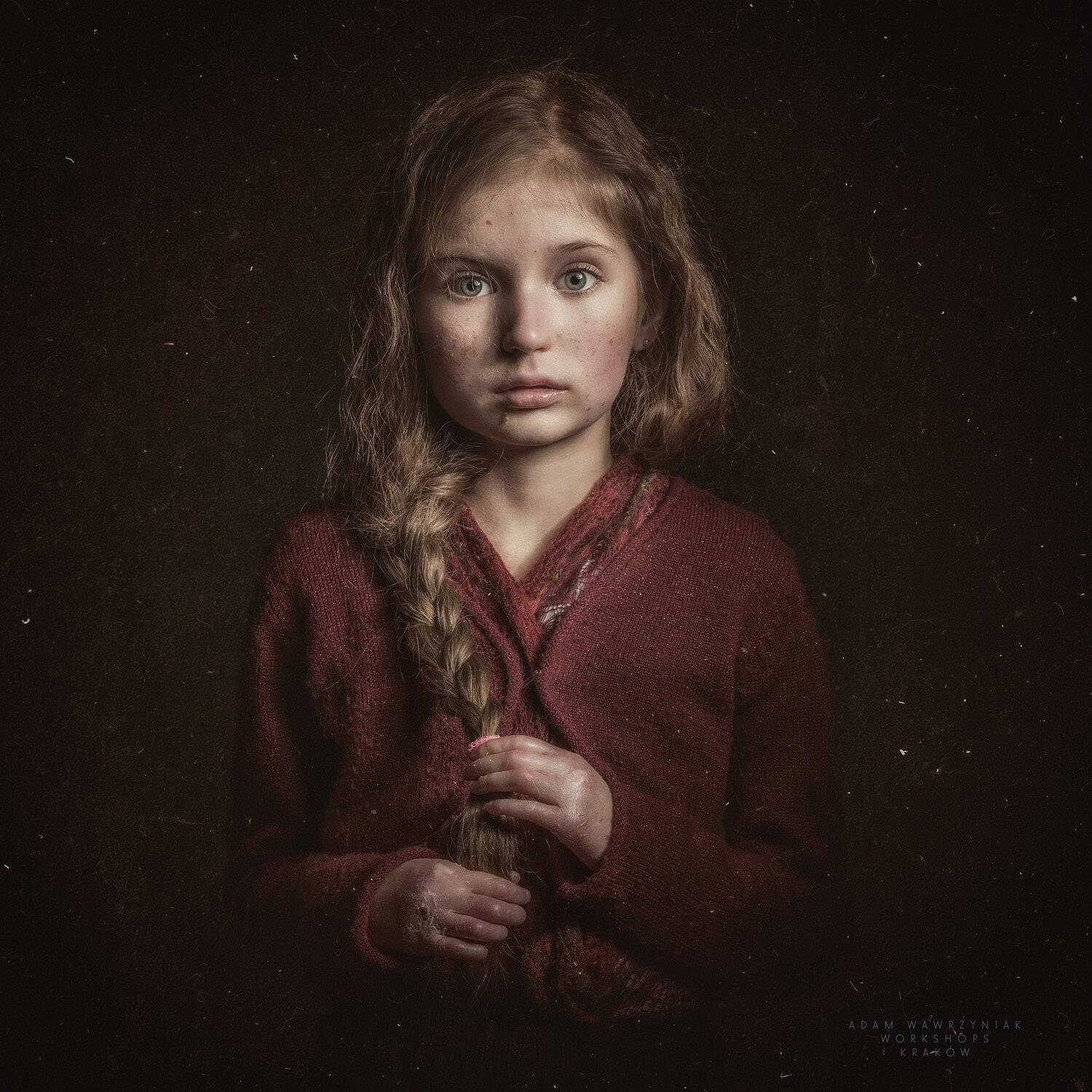 EpidermolysisBullosa, Adam Wawrzyniak