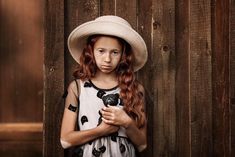 портрет, витилиго, модель, дети Диана фото превью