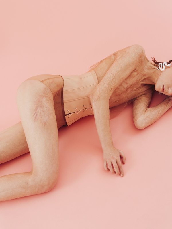 Refractory фото превью