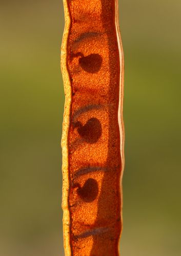 Поздравляю, у вас будет тройня.