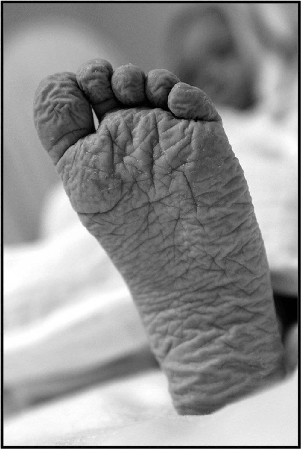 ступня,ч/б,, Качурин Алексей