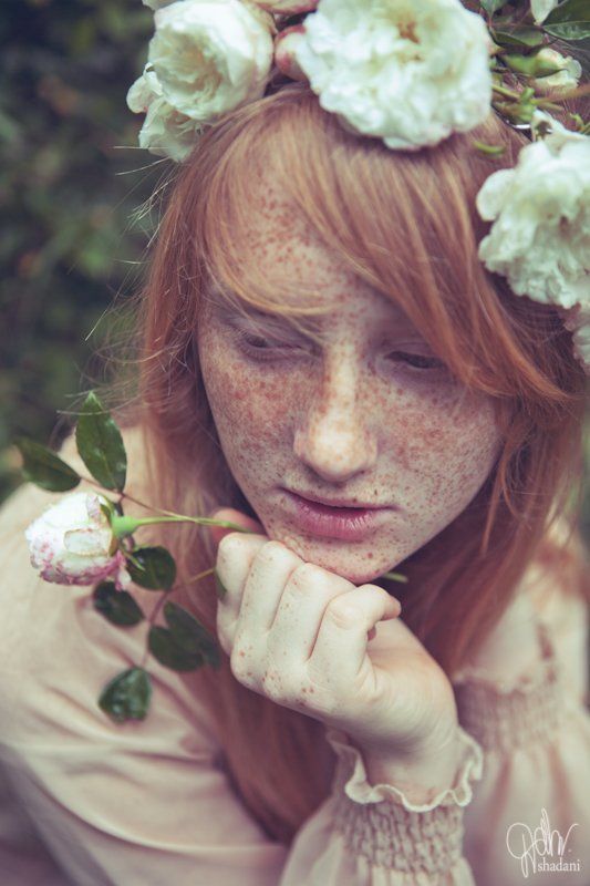 éphélide фото превью