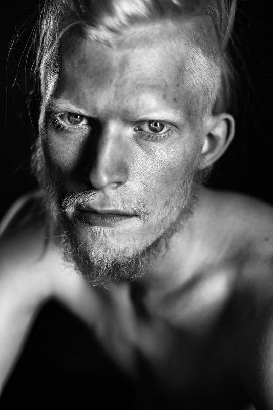 Albino фото превью