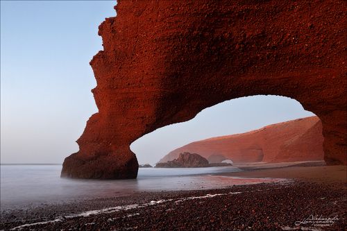 Слоновья нога