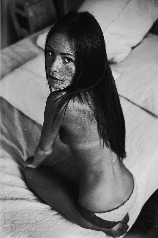 freckles фото превью