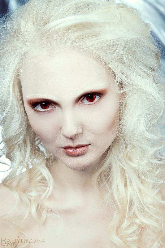 Альбинос фото превью