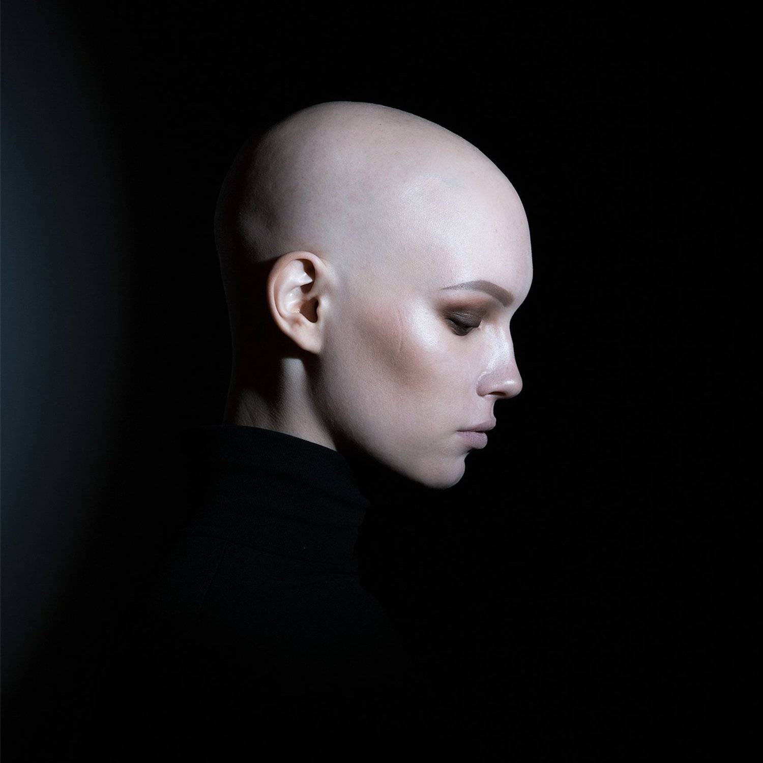 Алопеция, девушка, без волос, Дарья Комарова